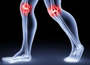 ဒူး arthrosis ၏ဖွံ့ဖြိုးတိုးတက်မှုအတွက်အကြောင်းပြချက်